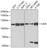 Anti-CASK antibody used in Western Blot (WB). GTX53920