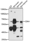 Anti-CaMKIV antibody used in Western Blot (WB). GTX53923