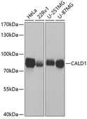 Anti-Caldesmon antibody used in Western Blot (WB). GTX53924
