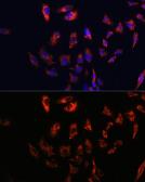 Anti-CD74 antibody used in Immunocytochemistry/ Immunofluorescence (ICC/IF). GTX53927