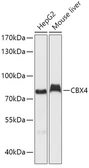Anti-CBX4 antibody used in Western Blot (WB). GTX53928