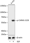 Anti-CARM1 (phospho Ser228) antibody used in Western Blot (WB). GTX53931