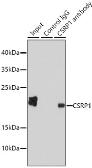 Anti-CSRP1 antibody used in Immunoprecipitation (IP). GTX53932