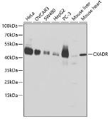Anti-Coxsackie Adenovirus Receptor antibody used in Western Blot (WB). GTX53942