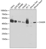 Anti-Coxsackie Adenovirus Receptor antibody used in Western Blot (WB). GTX53942