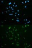 Anti-Chk2 antibody used in Immunocytochemistry/ Immunofluorescence (ICC/IF). GTX53946