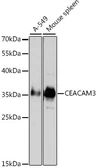 Anti-CD66d antibody used in Western Blot (WB). GTX53948