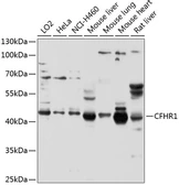 Anti-CFHL1 antibody used in Western Blot (WB). GTX53951