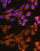 Anti-Properdin antibody used in Immunocytochemistry/ Immunofluorescence (ICC/IF). GTX53957