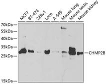 Anti-CHMP2B antibody used in Western Blot (WB). GTX53958