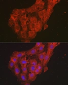 Anti-CXCL1 / GRO alpha antibody used in Immunocytochemistry/ Immunofluorescence (ICC/IF). GTX53966