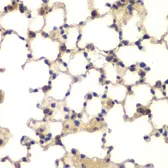 Anti-CGBP antibody used in IHC (Paraffin sections) (IHC-P). GTX53967