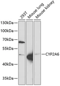 Anti-Cytochrome P450 2A6 antibody used in Western Blot (WB). GTX53968