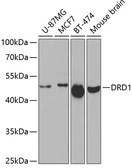 Anti-Dopamine Receptor D1 antibody used in Western Blot (WB). GTX53978