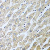 Anti-PKR antibody used in IHC (Paraffin sections) (IHC-P). GTX53983