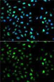 Anti-Dysbindin antibody used in Immunocytochemistry/ Immunofluorescence (ICC/IF). GTX53985