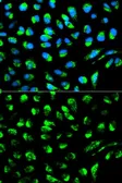 Anti-DCI antibody used in Immunocytochemistry/ Immunofluorescence (ICC/IF). GTX53991
