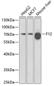 Anti-Factor XII antibody used in Western Blot (WB). GTX53993