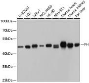 Anti-Fumarate hydratase antibody used in Western Blot (WB). GTX53996
