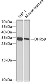 Anti-DHRS9 antibody used in Western Blot (WB). GTX54001