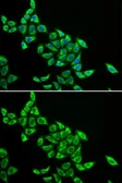 Anti-DLAT antibody used in Immunocytochemistry/ Immunofluorescence (ICC/IF). GTX54002