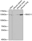 Anti-FBXO11 antibody used in Western Blot (WB). GTX54008