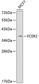 Anti-CD23 antibody used in Western Blot (WB). GTX54009