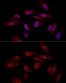 Anti-EIF6 antibody used in Immunocytochemistry/ Immunofluorescence (ICC/IF). GTX54010