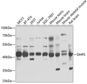 Anti-DHPS antibody used in Western Blot (WB). GTX54011
