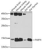 Anti-FABP4 antibody used in Western Blot (WB). GTX54016
