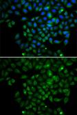 Anti-FABP4 antibody used in Immunocytochemistry/ Immunofluorescence (ICC/IF). GTX54016