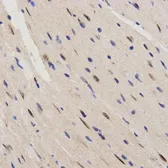 Anti-RAI16 antibody used in IHC (Paraffin sections) (IHC-P). GTX54018