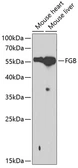 Anti-Fibrinogen beta antibody used in Western Blot (WB). GTX54019