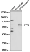 Anti-TEL antibody used in Immunoprecipitation (IP). GTX54020