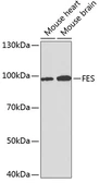 Anti-FES antibody used in Western Blot (WB). GTX54025