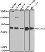 Anti-DDAH2 antibody used in Western Blot (WB). GTX54028