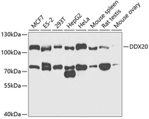 Anti-Gemin 3 antibody used in Western Blot (WB). GTX54029