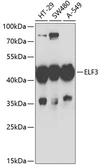 Anti-ESE1 antibody used in Western Blot (WB). GTX54033
