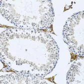 Anti-Fibromodulin antibody used in IHC (Paraffin sections) (IHC-P). GTX54035