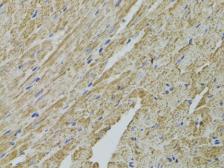 Anti-FHIT antibody used in IHC (Paraffin sections) (IHC-P). GTX54037