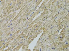 Anti-FHIT antibody used in IHC (Paraffin sections) (IHC-P). GTX54037