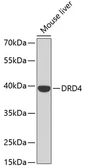 Anti-Dopamine Receptor D4 antibody used in Western Blot (WB). GTX54038