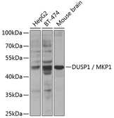 Anti-DUSP1 antibody used in Western Blot (WB). GTX54042