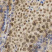 Anti-ELAVL1 / HuR antibody used in IHC (Paraffin sections) (IHC-P). GTX54044