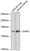 Anti-DAP Kinase 1 antibody used in Western Blot (WB). GTX54047