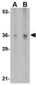 Anti-IL33 (pro) antibody used in Western Blot (WB). GTX54067