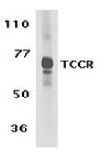 Anti-IL27 Receptor alpha antibody used in Western Blot (WB). GTX54076