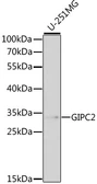 Anti-GIPC2 antibody used in Western Blot (WB). GTX54083