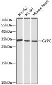 Anti-Glycophorin C antibody used in Western Blot (WB). GTX54084