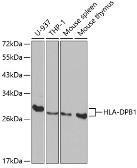 Anti-HLA-DPB1 antibody used in Western Blot (WB). GTX54086
